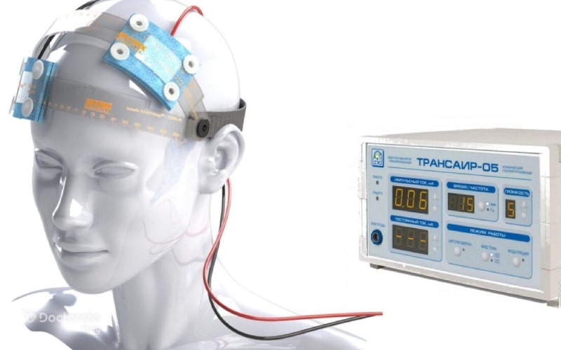 تی دی سی اس (tDCS) یا تحریک الکتریکی مغز چیست؟