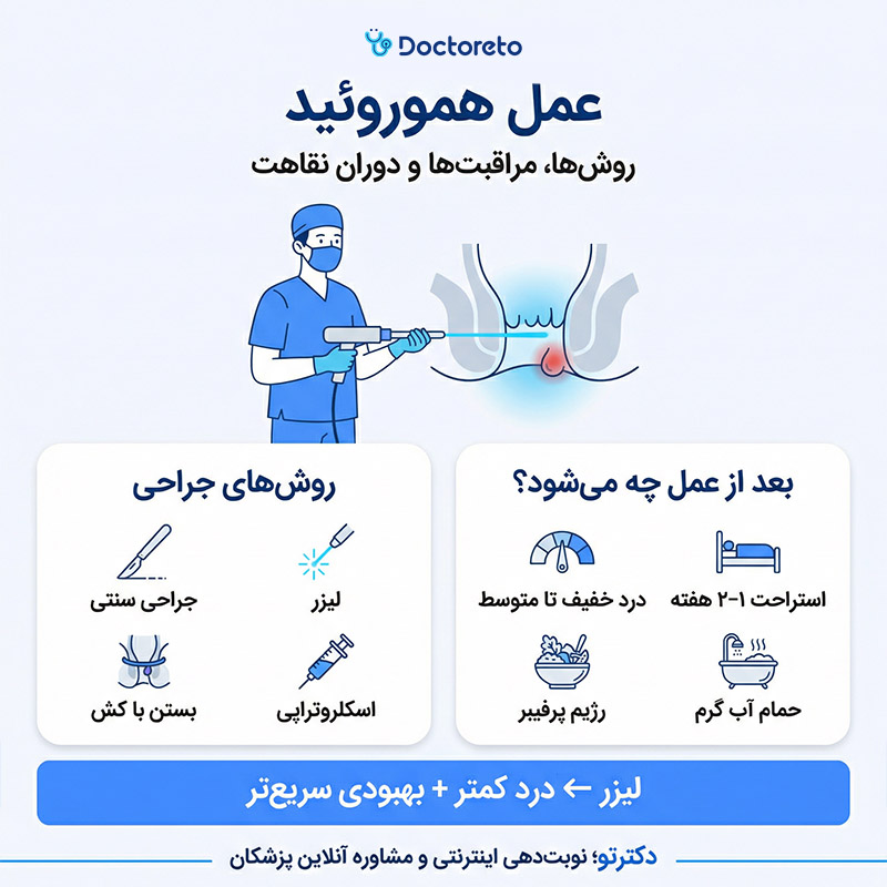 اینفوگرافی عمل هموروئید