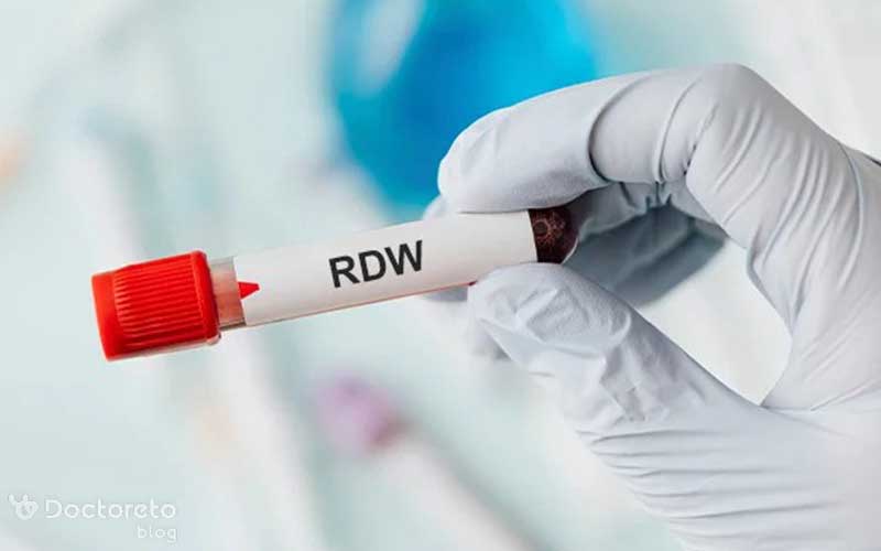 RDW در آزمایش خون نشانه چیست؟