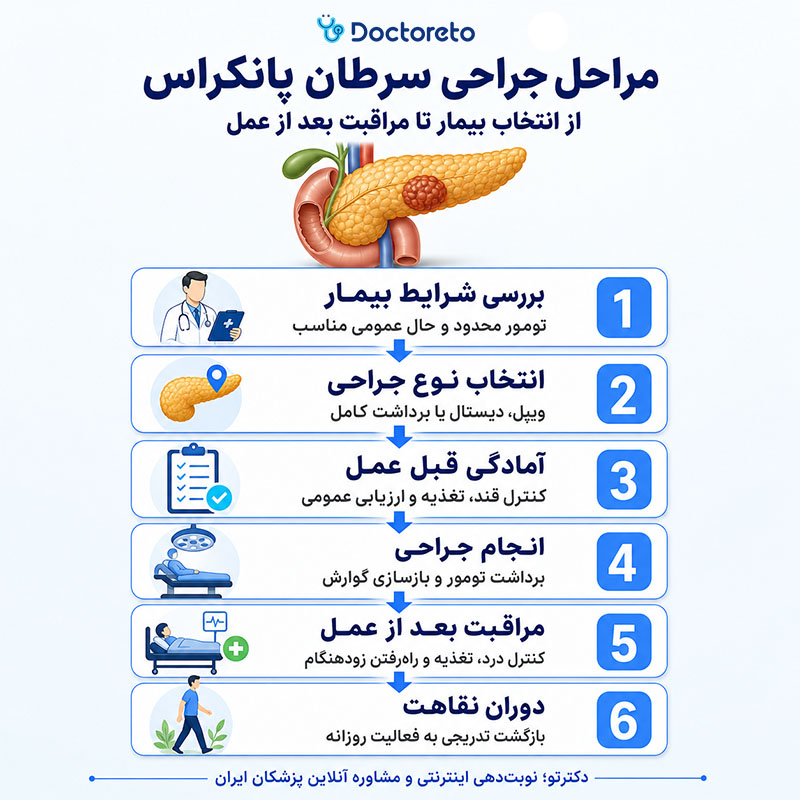 اینفوگرافی جراحی سرطان پانکراس