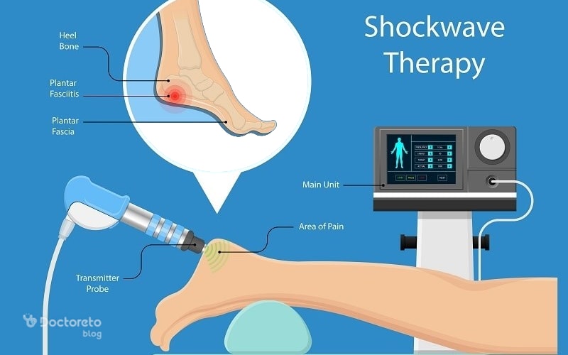 کاربرد شاک ویو تراپی خار پاشنه چیست؟