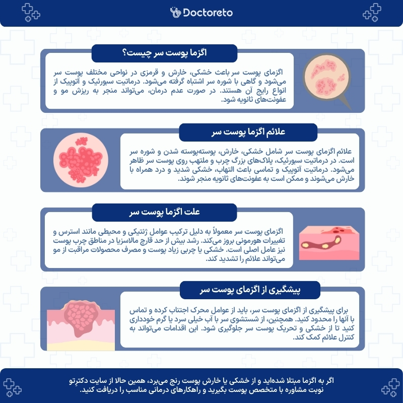 اینفوگرافی اگزمای پوست سر