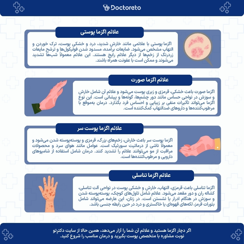 اینفوگرافی علائم اگزما