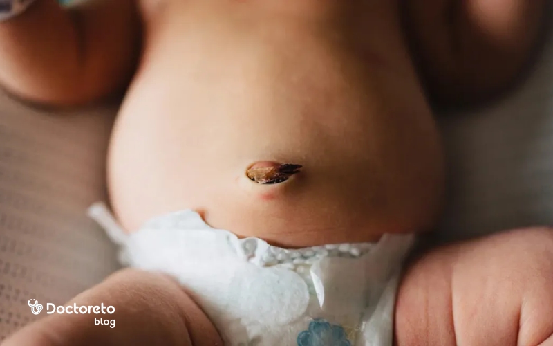 عکس ناف نوزاد بعد از افتادن