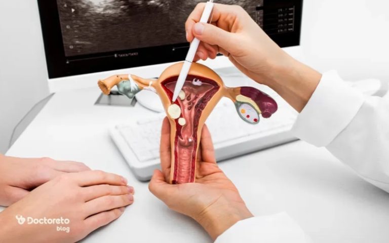 هرآنچه باید درباره سندرم تخمدان پلی کیستیک بدانید