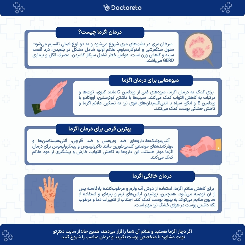 اینفوگرافی درمان اگزما