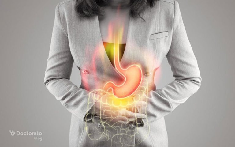 بررسی نشانه ها و علائم رفلاکس معده