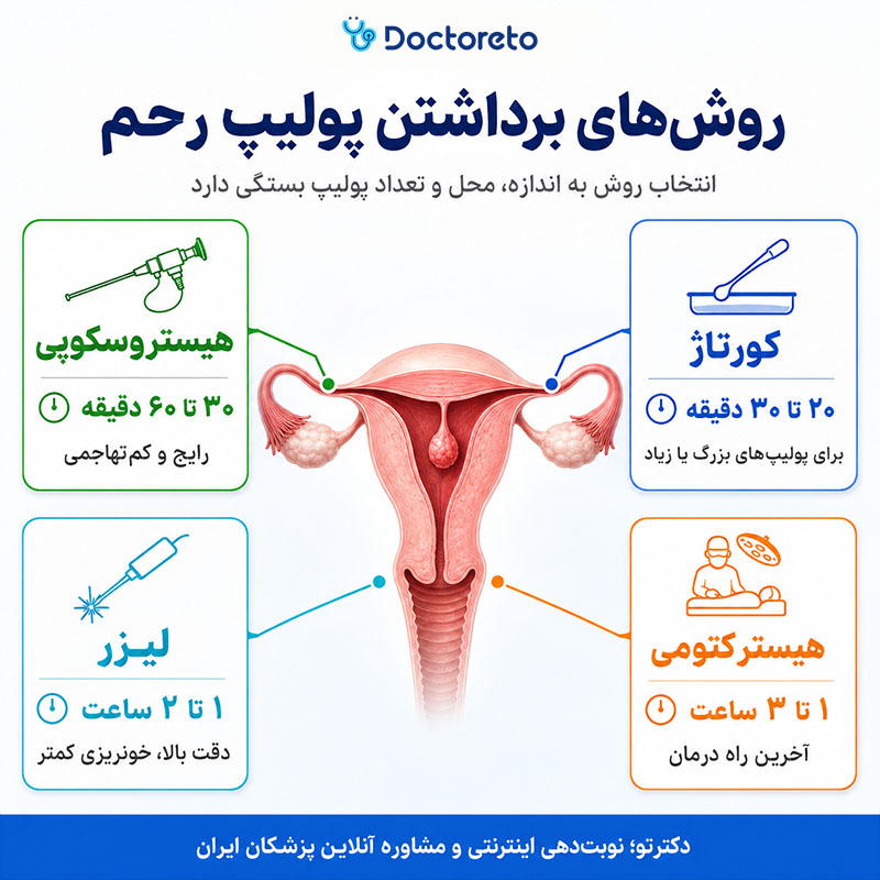 اینفوگرافی عمل برداشتن پولیپ رحم