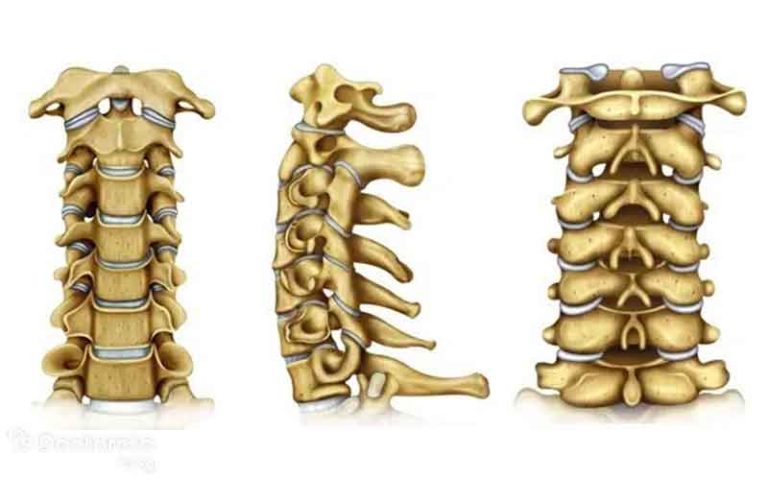 چگونه خطرات دیسک گردن را برطرف کنیم؟