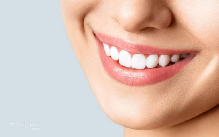 کامپوزیت دندان خرگوشی چیست؟