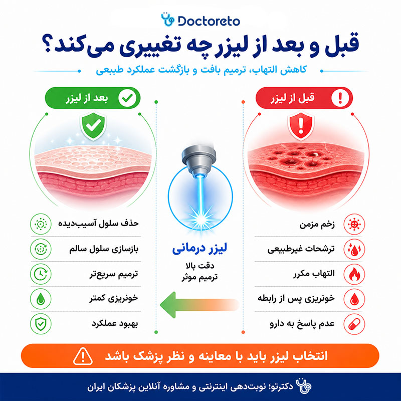 اینفوگرافی لیزر زخم دهانه رحم
