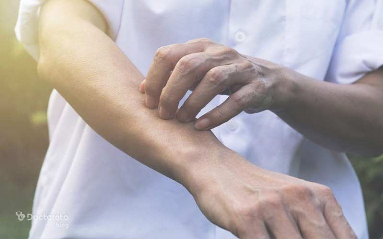 کهیر گرمایی یا کولینرژیک: بررسی علل، علائم و روش های درمان آن