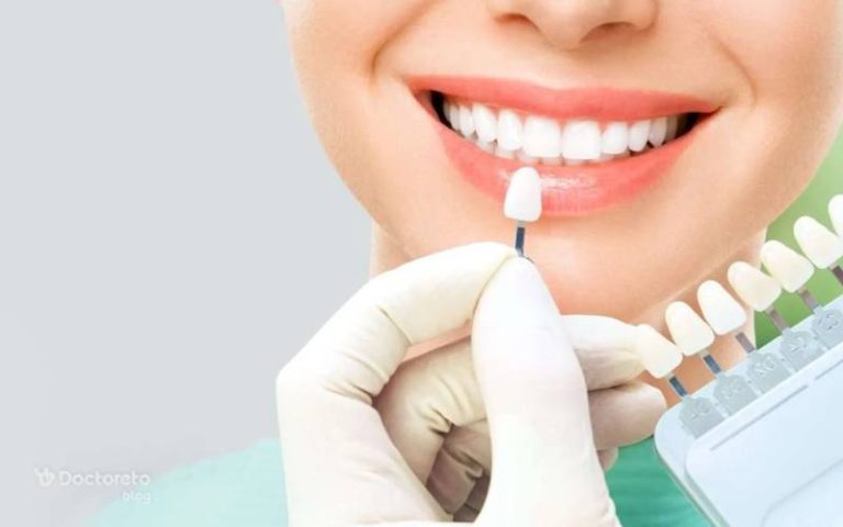 کامپوزیت ونیر و هر آنچه باید درباره آن بدانید.