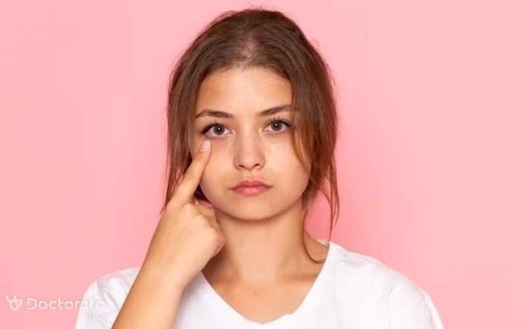 علائم کبد چرب بر روی پوست و چهره چیست؟