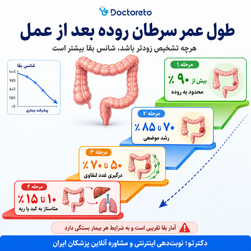 اینفوگرافی طول عمر بیماران سرطان روده بزرگ