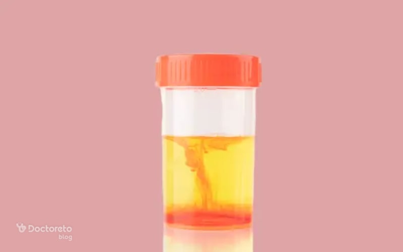 blood مثبت در آزمایش ادرار نشانه چیست؟
