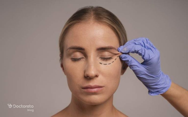 بررسی کامل مزایا و معایب لیفت شقیقه با بوتاکس