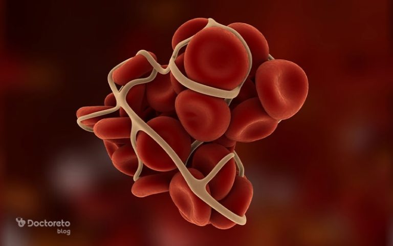 هموفیلی ارثی چیست و تا چه اندازه خطرناک است؟
