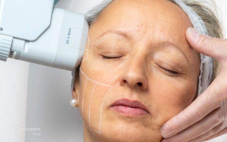 عوارض هایفوتراپی صورت را چگونه کاهش دهیم؟