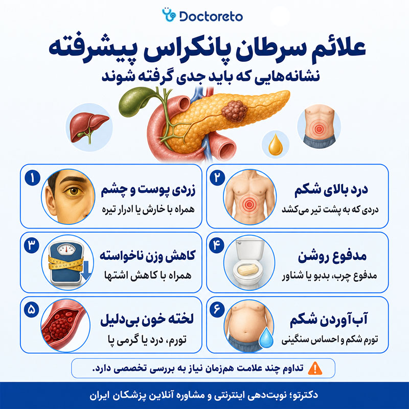 اینفوگرافی علائم سرطان پانکراس پیشرفته