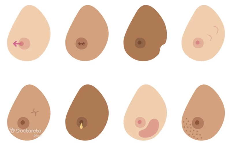 علائم سرطان سینه در زنان با عکس در سنین و شرایط مختلف