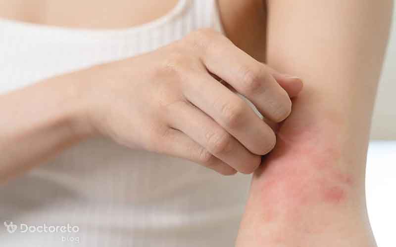 دیابت و بیماری پوستی چه ارتباطی با هم دارند؟
