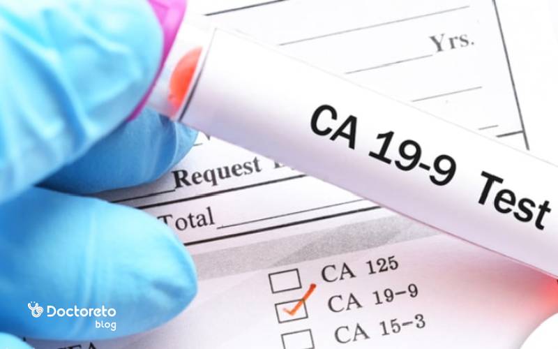 افزایش مارکر CA 19-9