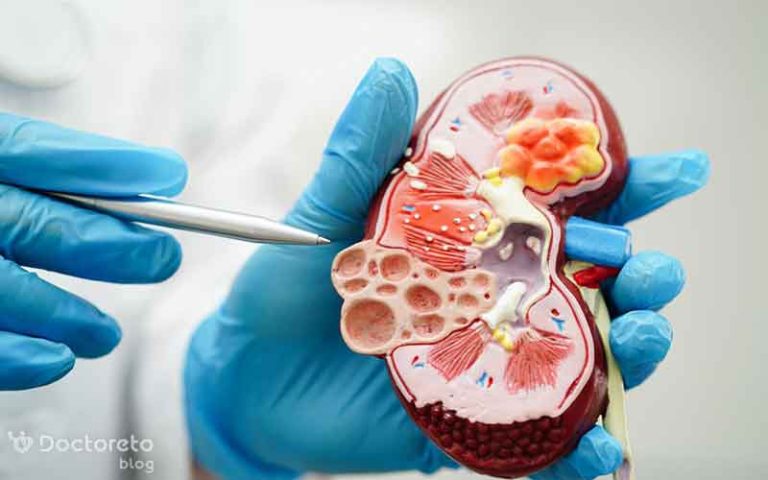 دیابت و بیماری های کلیوی چه ارتباطی با یکدیگر دارند؟