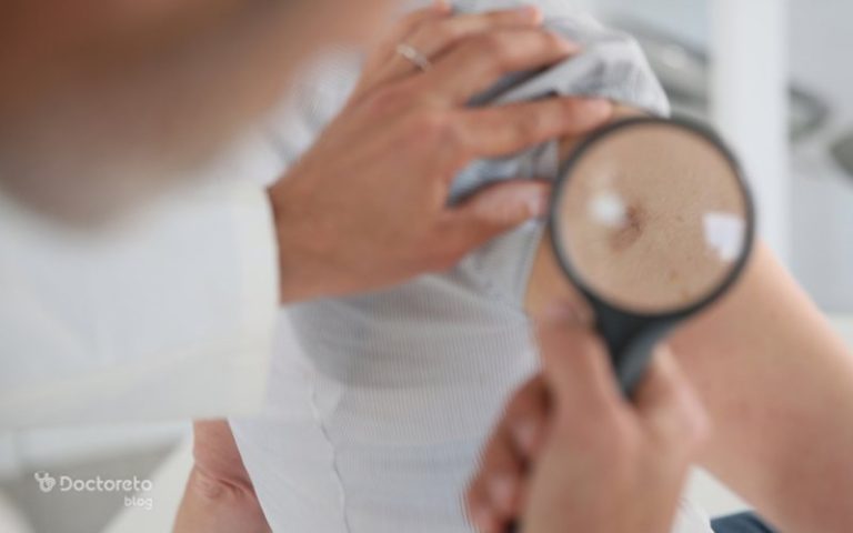 علائم سرطان پوست را بشناسیم