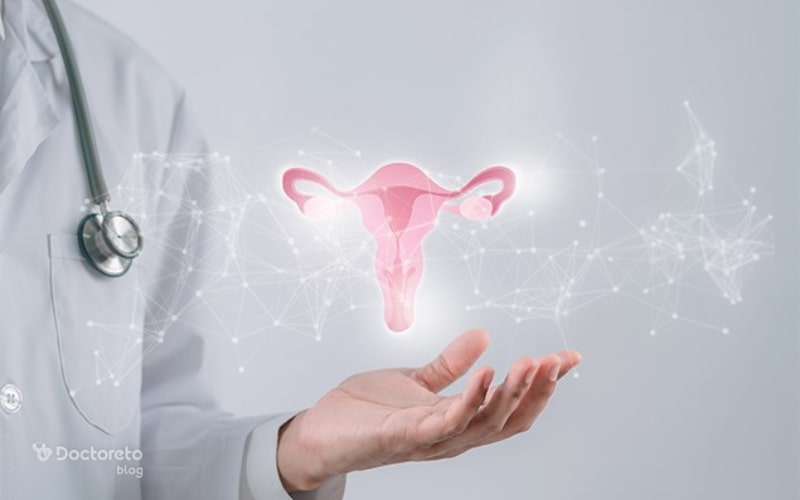 علت تخمدان پلی کیستیک چیست؟