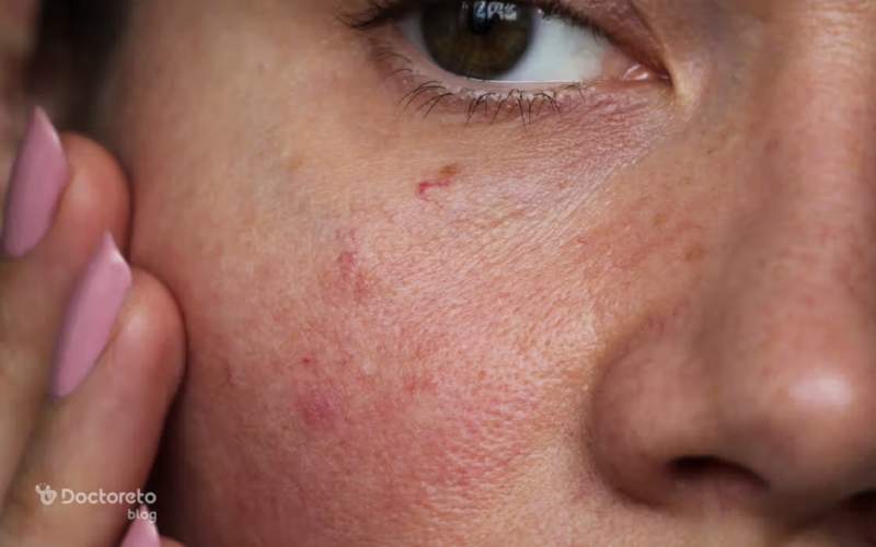 علائم بارداری از روی چهره چیست؟