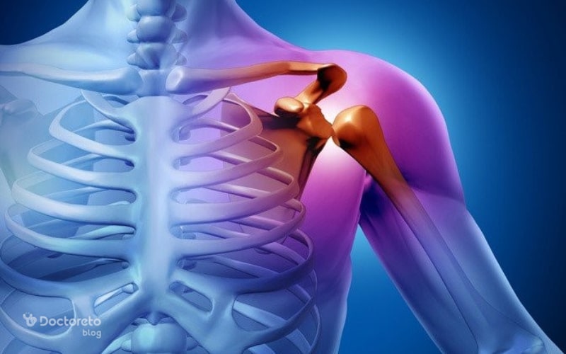 عکس در رفتگی کتف بدین شکل است.