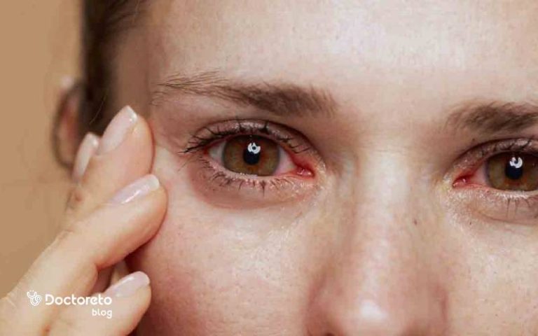 تاثیر کم خونی بر چشم تا چه اندازه خطرناک است؟