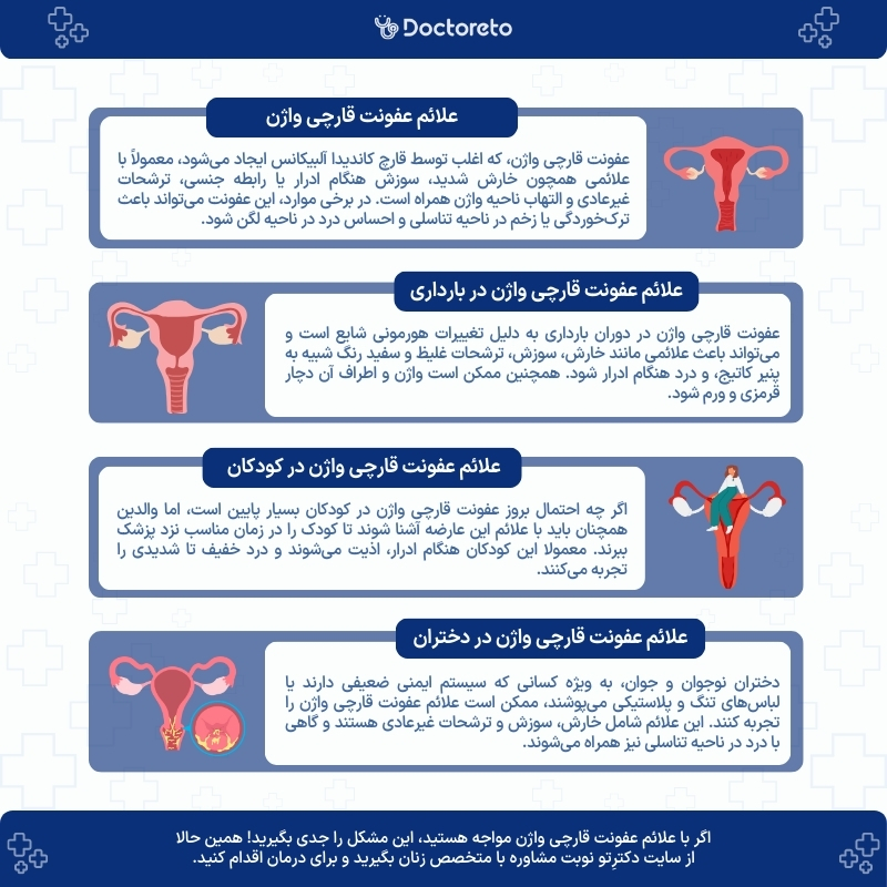 اینفوگرافی علائم عفونت قارچی واژن