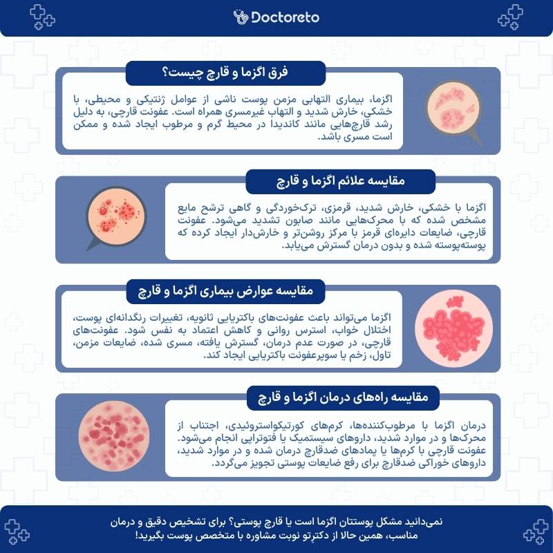 اینفوگرافی فرق اگزما و قارچ پوستی