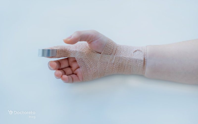 نحوه جا انداختن در رفتگی انگشت دست چگونه است؟