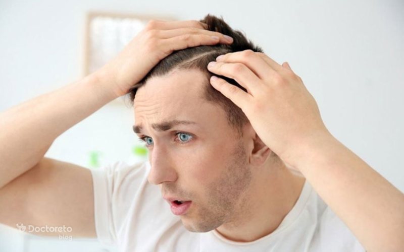 درمان ریزش مو در اثر کم کاری تیروئید چیست؟