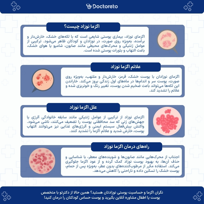 اینفوگرافی اگزما نوزاد