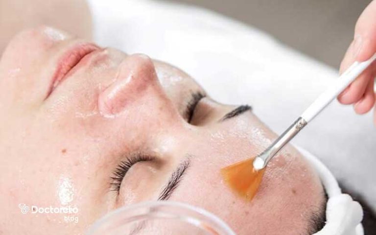 اسید تراپی برای لک تا چقدر در رفع آن موثر است؟
