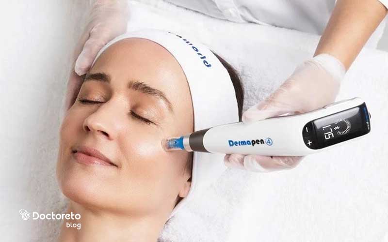 آر اف بهتر است یا میکرونیدلینگ؟