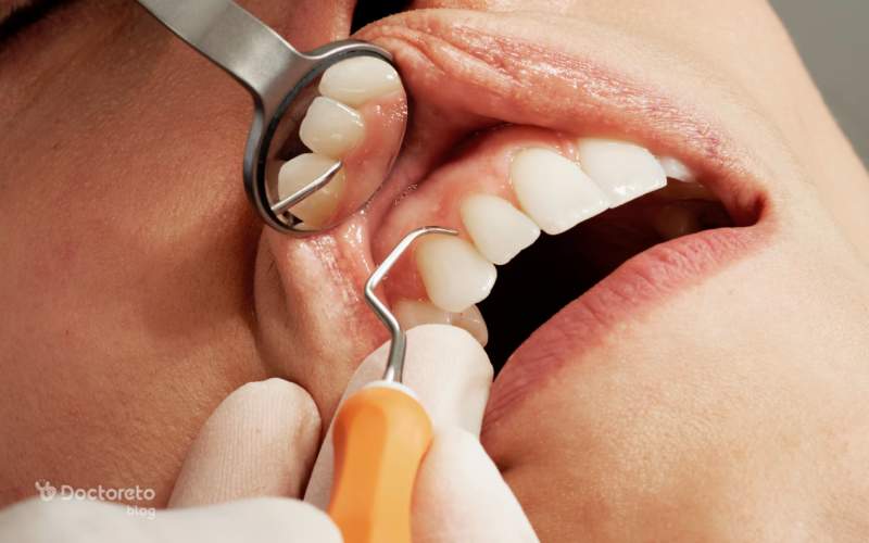 کاربردهای کاشت دندان چیست؟