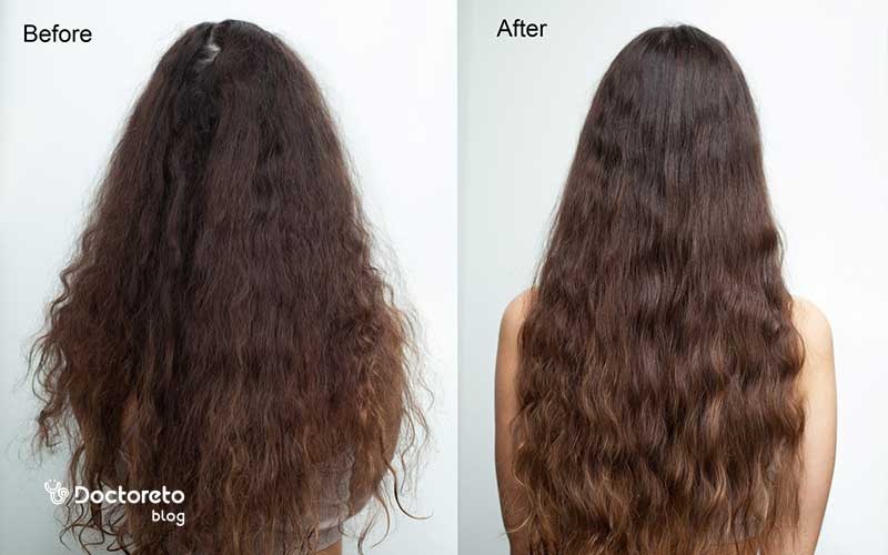 عکس قبل و بعد اسید تراپی مو حاکی از تغییرات زیادی است.