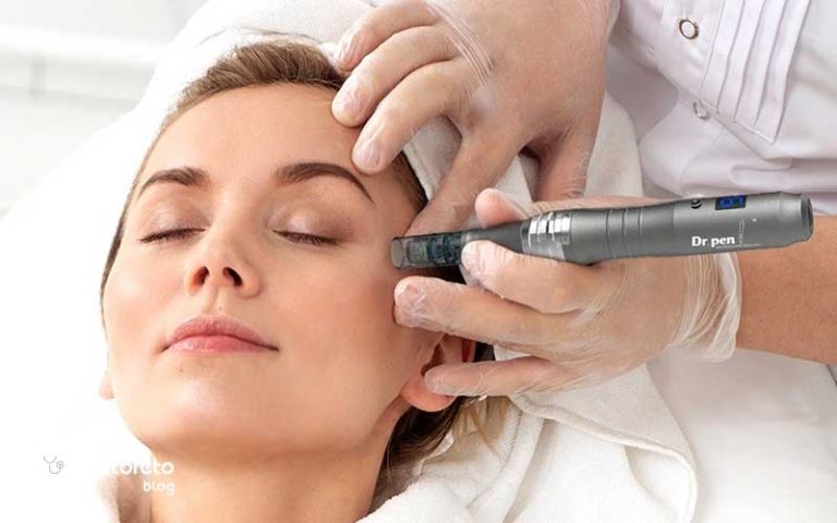 میکرونیدلینگ برای جای جوش چقدر موثر است؟