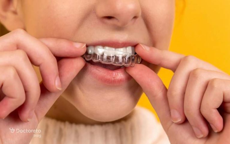 ریتینر ارتودنسی و هر آنچه که باید درباره آن بدانید