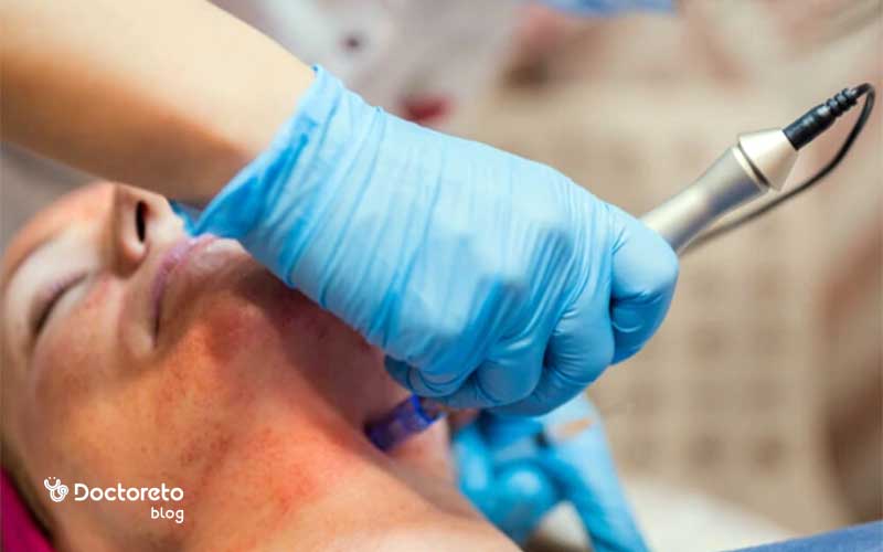 لک بعد از میکرونیدلینگ چرا ایجاد می شود؟