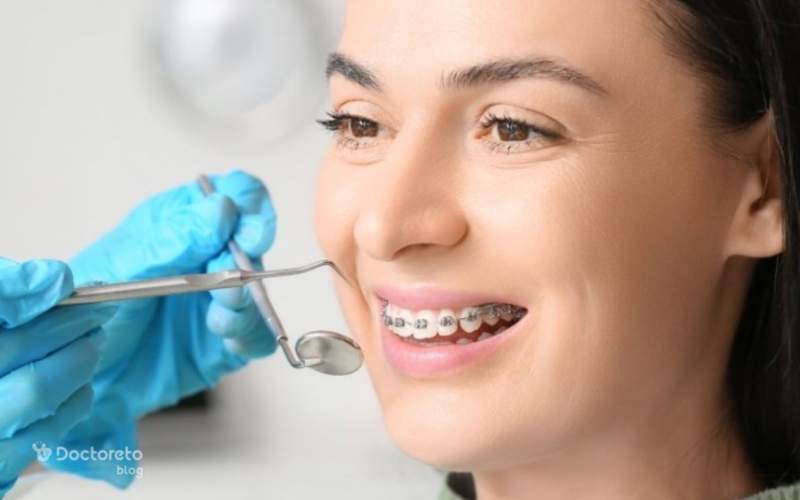 مراحل ارتودنسی چند گام است؟