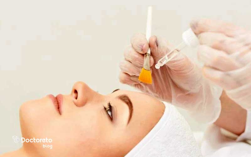 یکی از نکات مراقبت بعد از اسید تراپی پرهیز از لایه برداری است.