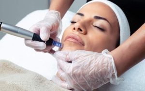 بررسی کامل تفاوت میکرونیدلینگ و مزونیدلینگ