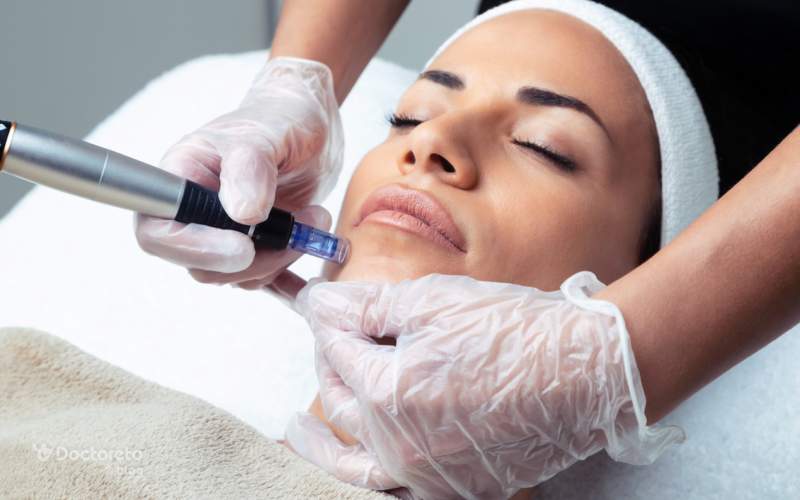 تفاوت میکرونیدلینگ و مزونیدلینگ در چیست؟