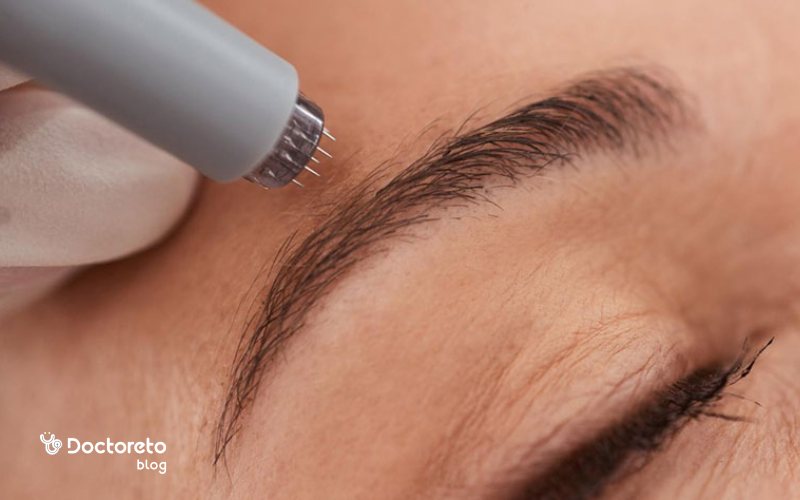 میکرونیدلینگ ابرو چقدر طول میکشه؟